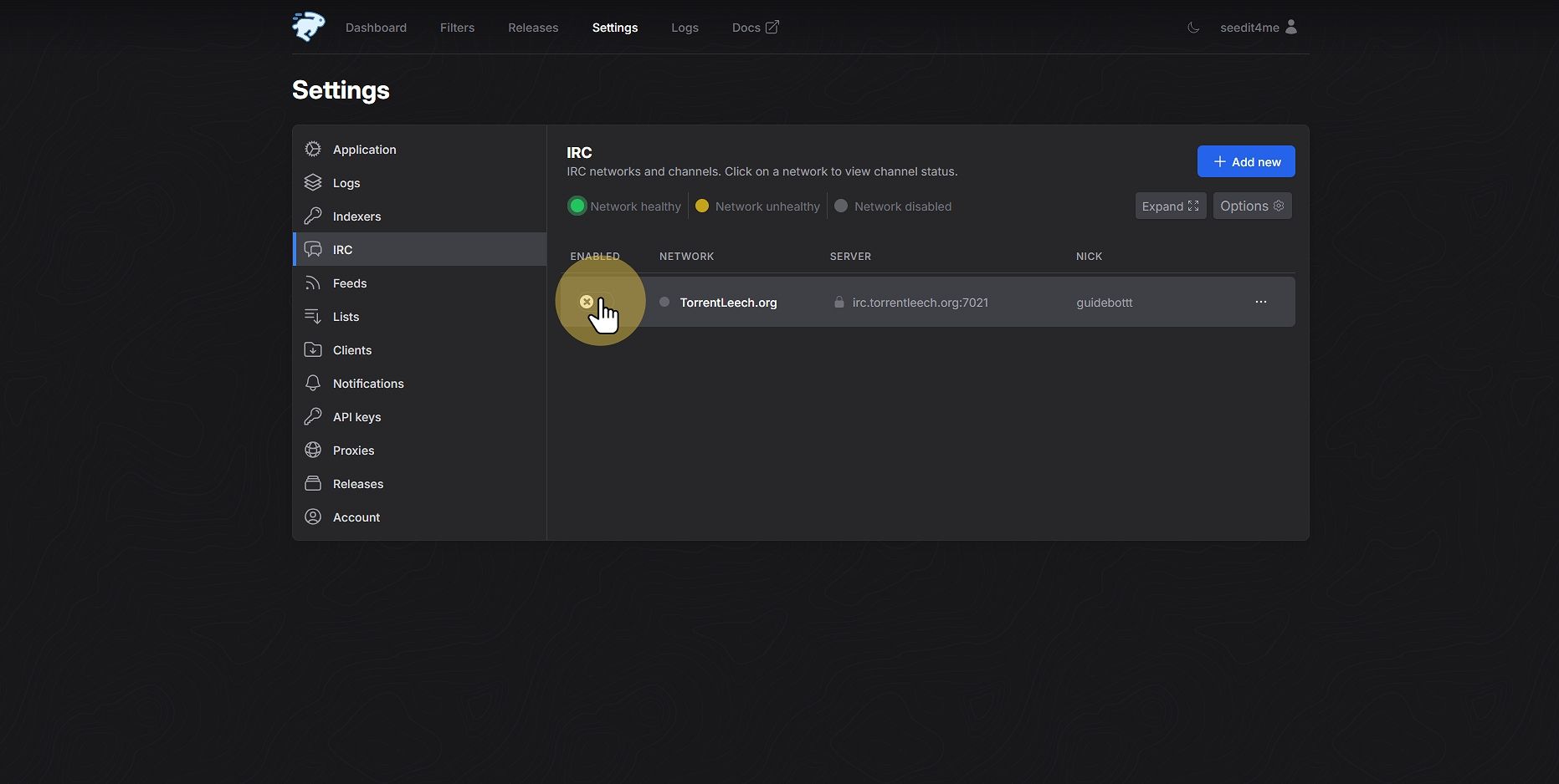 Click "Enable"